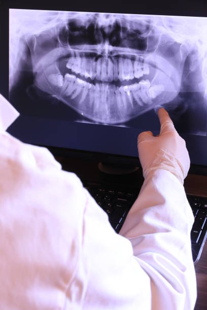 Best Emergency Gum Treatment in Monroe Manor, NJ